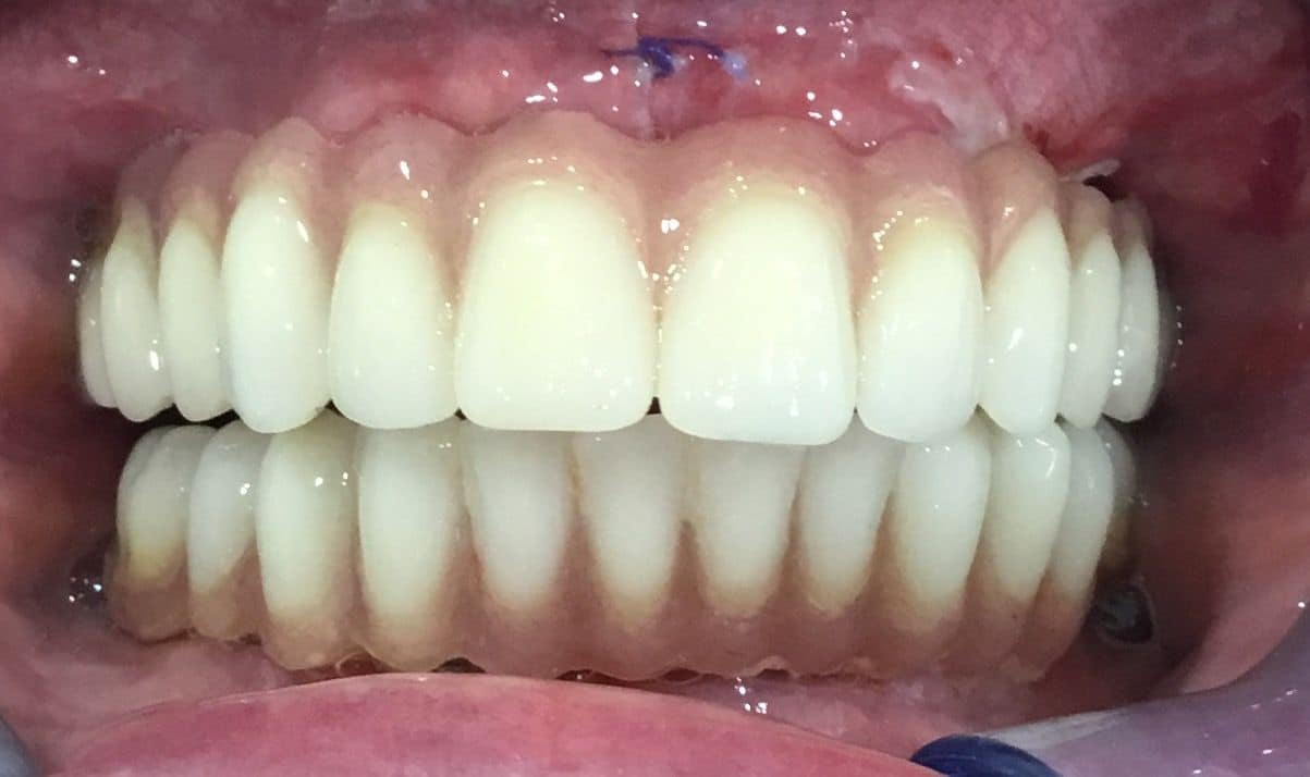 dente-6-ore-2