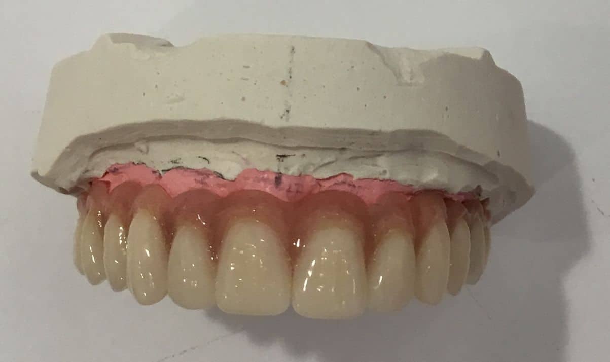 dente-6-ore-4